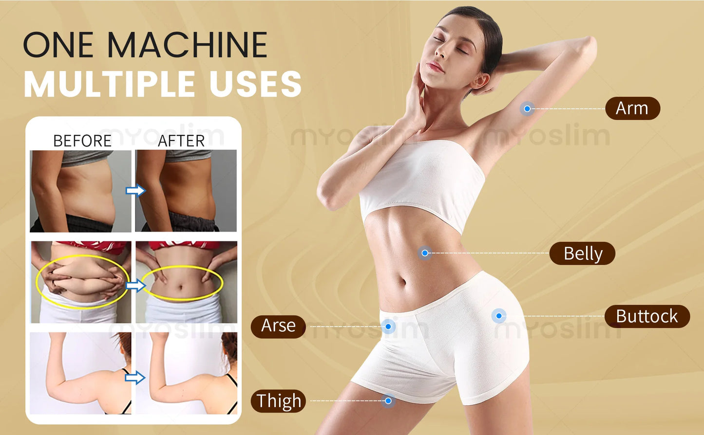 Myoslim RF High Intensity Electromagnetic Body Sculpting Machine