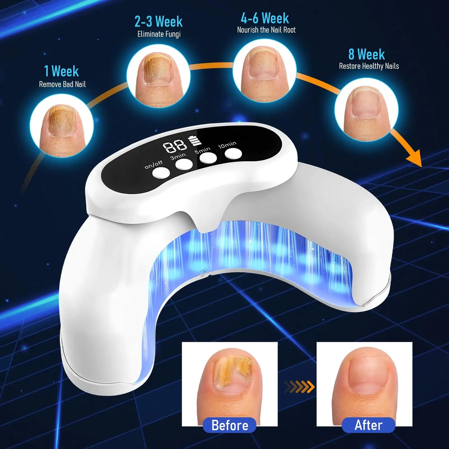 KTS 45W Nail Fungus Treatment Device With 30 LEDs 470nm 905nm