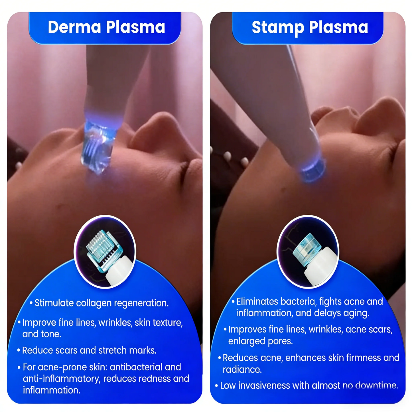MYOSLIM 8 In 1 Plasma Beauty Machine With Cold Warm Ozone Microdermabrasion