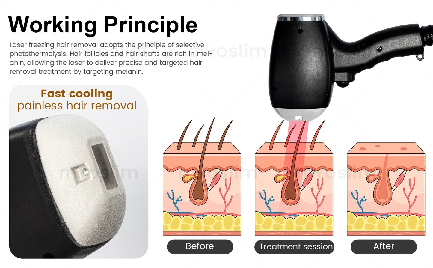 MYOSLIM Diode Laser Hair Removal Device Soprano 4 Wave 755 940 1064 808nm CE