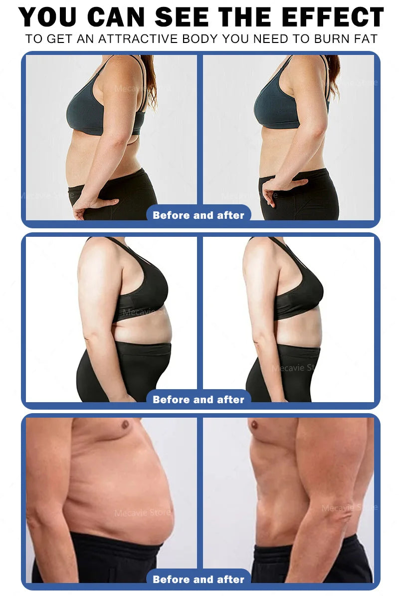 RF Body Contouring Machine Dual Handle Electromagnetic Weight Loss Device