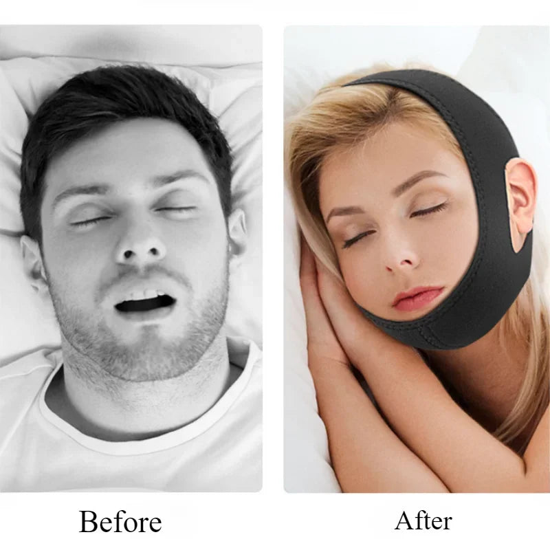 Anti Snore Chin Strap For Sleep Support And Snoring Reduction