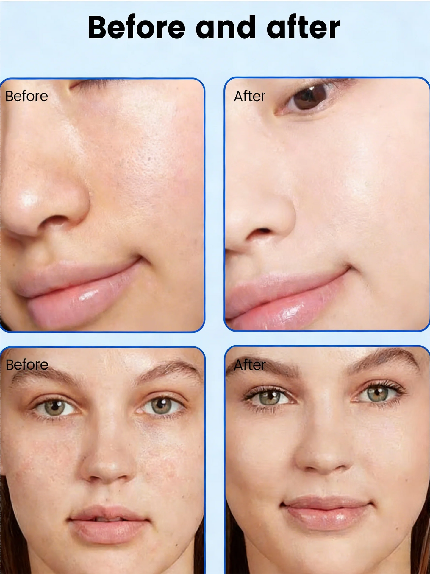 MYOSLIM 8 In 1 Plasma Beauty Machine With Cold Warm Ozone Microdermabrasion