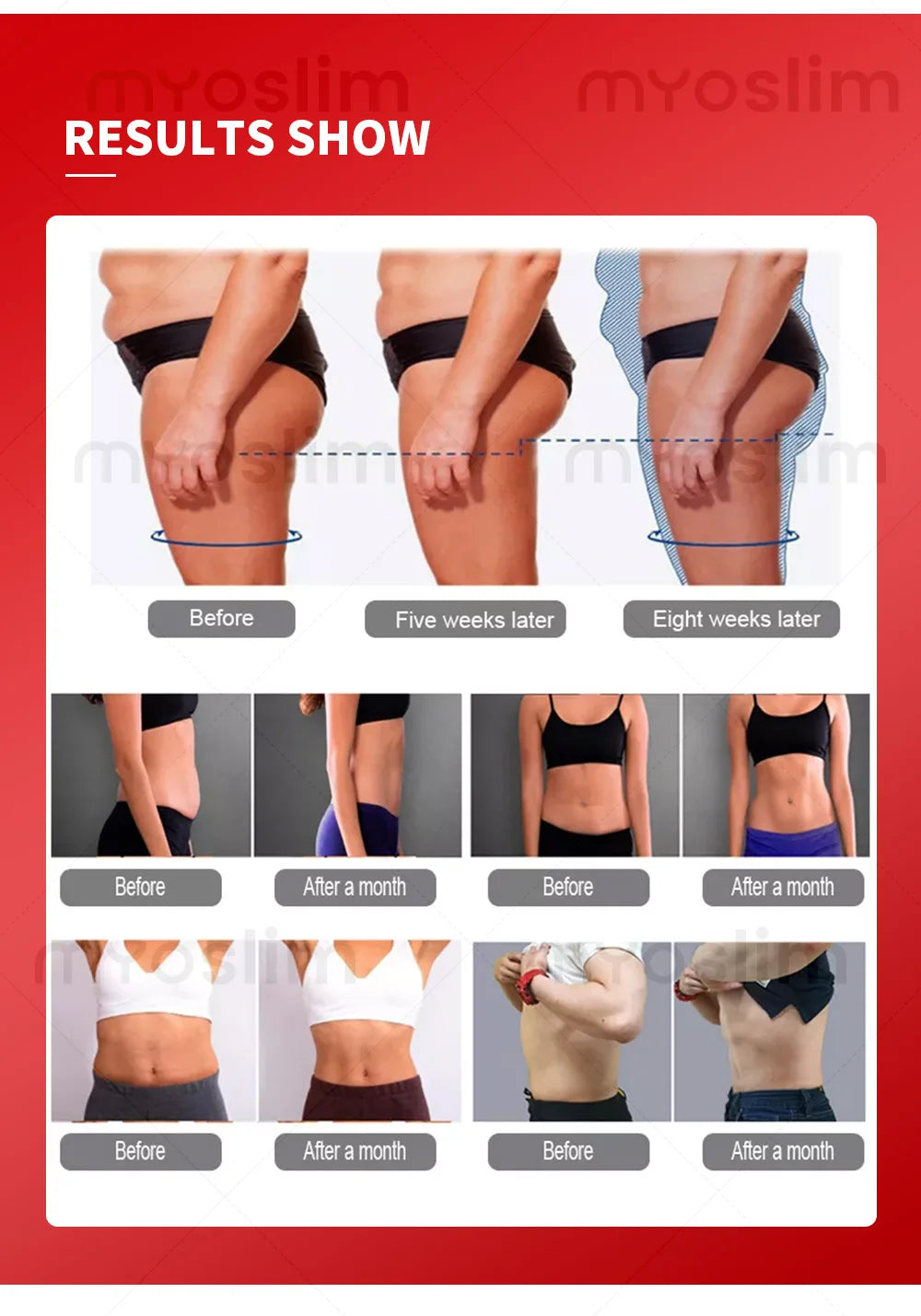 Myoslim 360 Inner Ball Roller EMS Body Contouring Device
