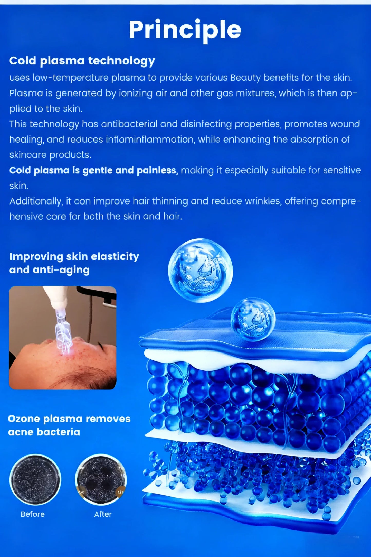 MYOSLIM 8 In 1 Plasma Beauty Machine With Cold Warm Ozone Microdermabrasion