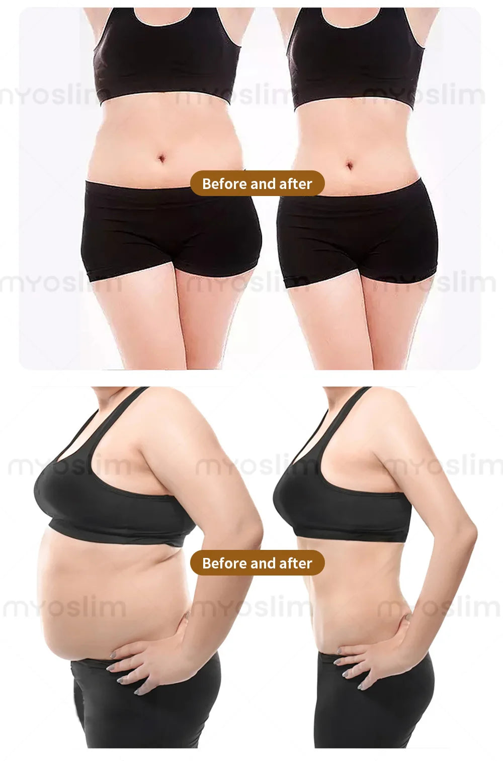 Myoslim EMS RF Machine Neo 15Tesla 6500W Sculpt Fat Reduction