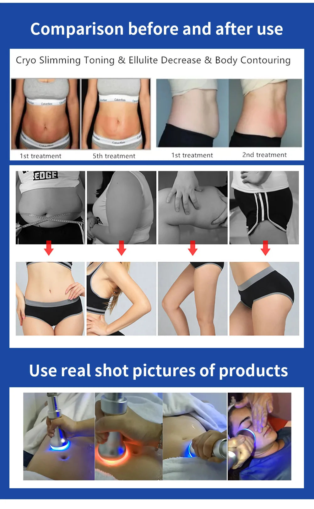 Myoslim Hot Cold Skin Firming Cryo Portable Facial Body Contouring