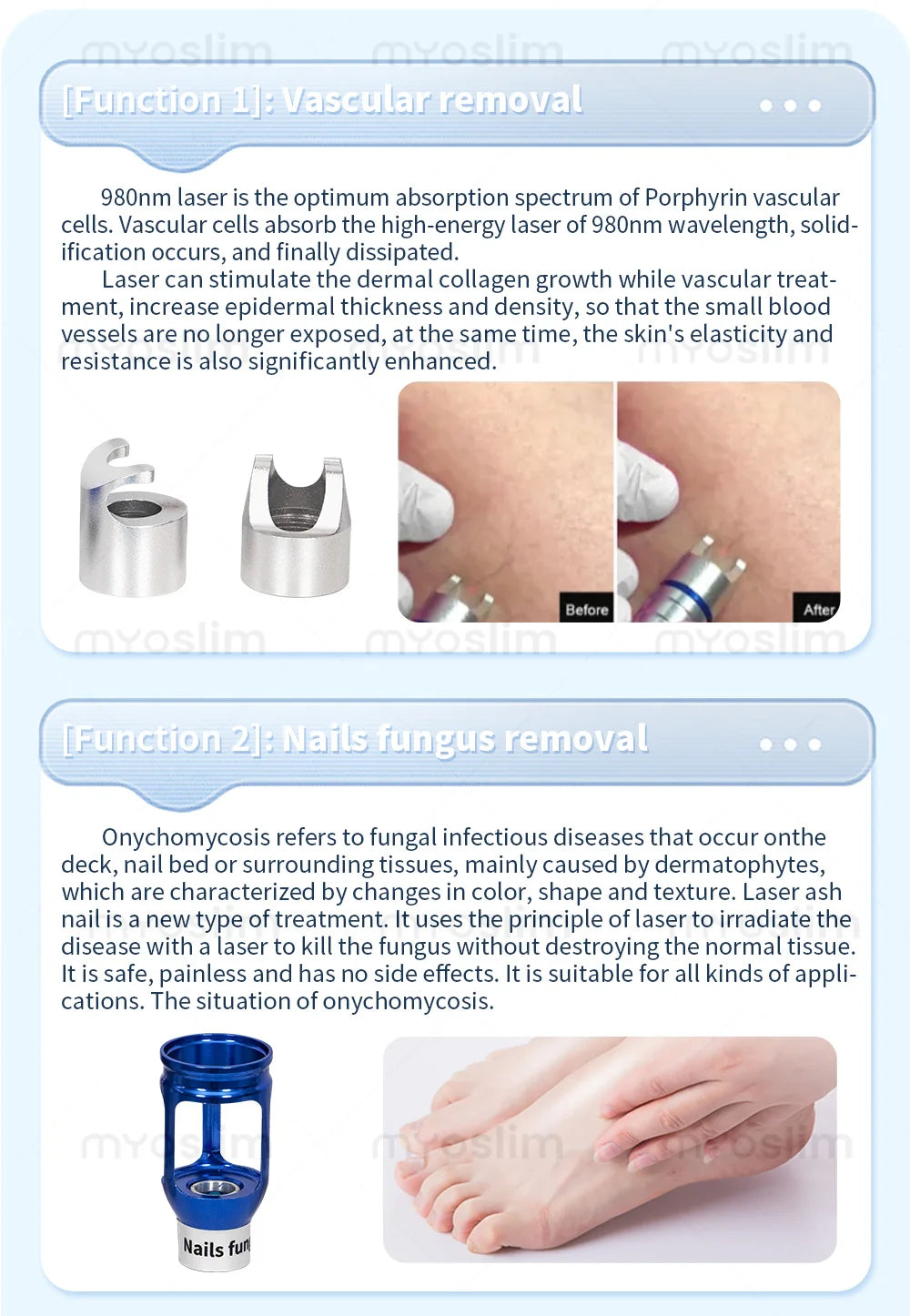 5 In 1 980nm Diode Laser Vascular Removal Nail Fungus