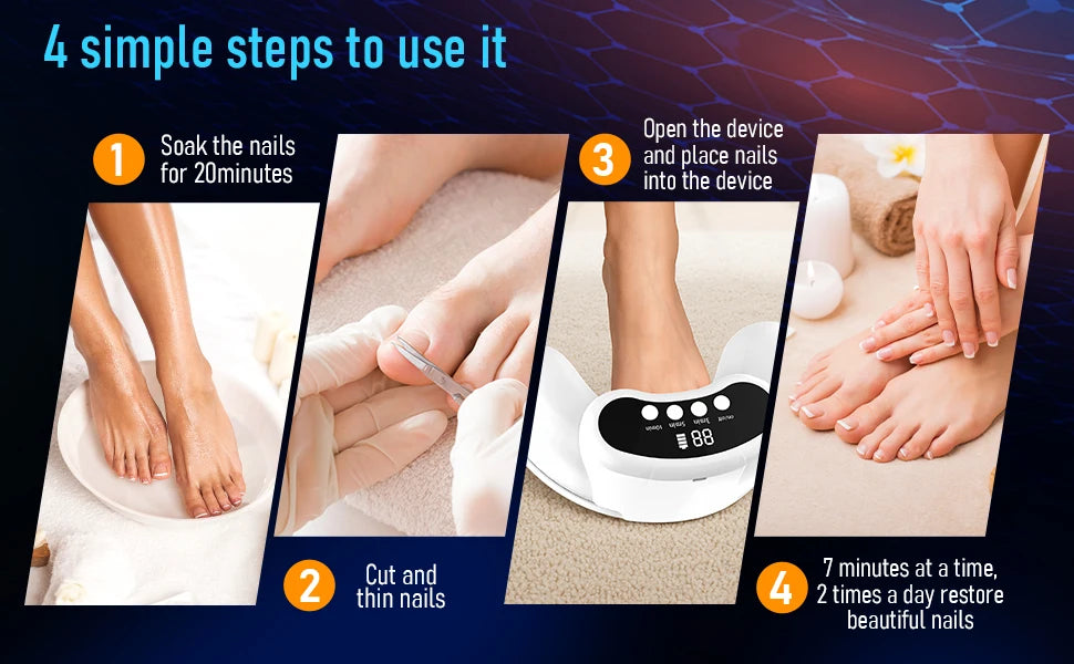 KTS 45W Nail Fungus Treatment Device With 30 LEDs 470nm 905nm