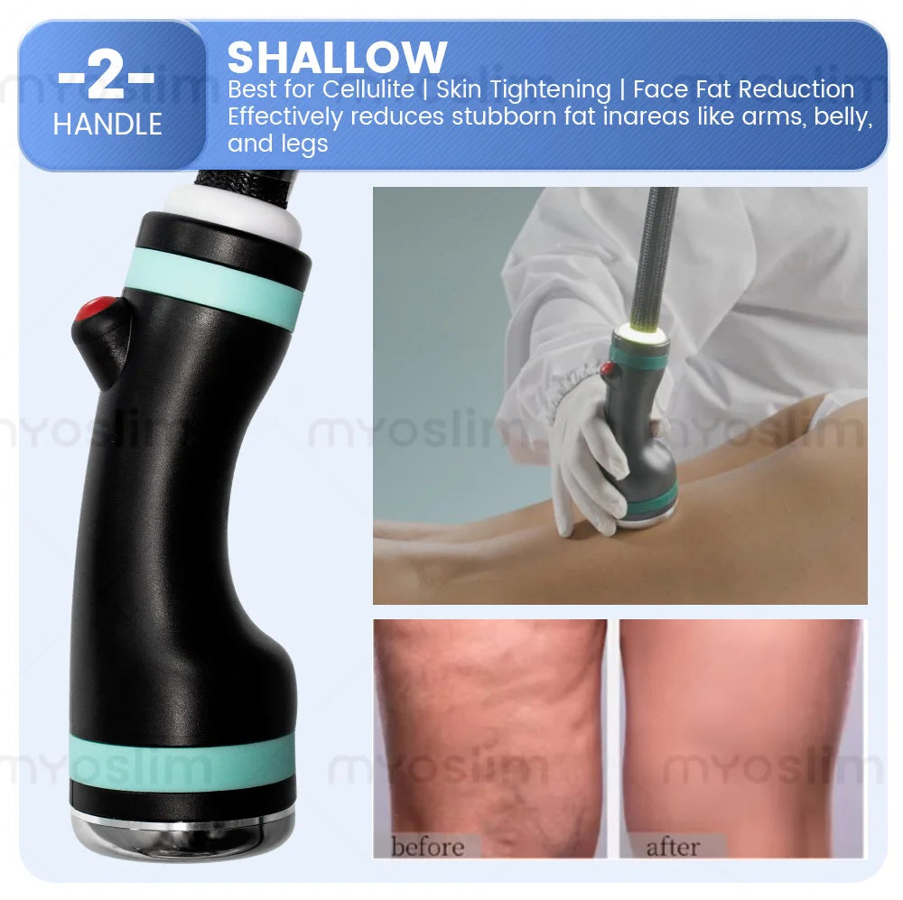 TAIXL 3-In-1 Ice Microwave Slimming Freezing Wave Massage