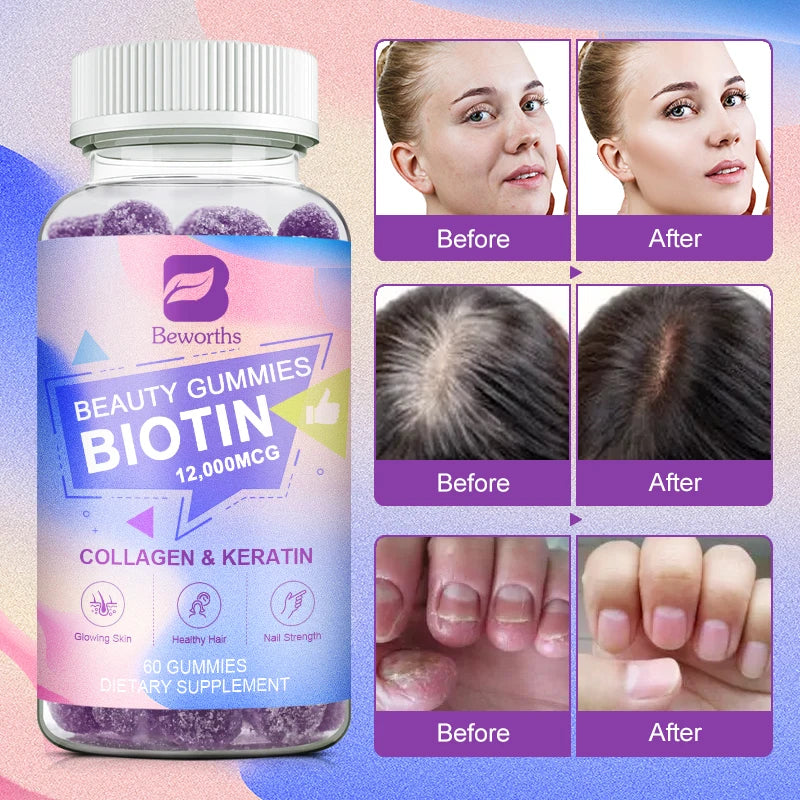 Beworths Collagen Biotin Gummies For Hair Growth And Skin Health Care Support Nails