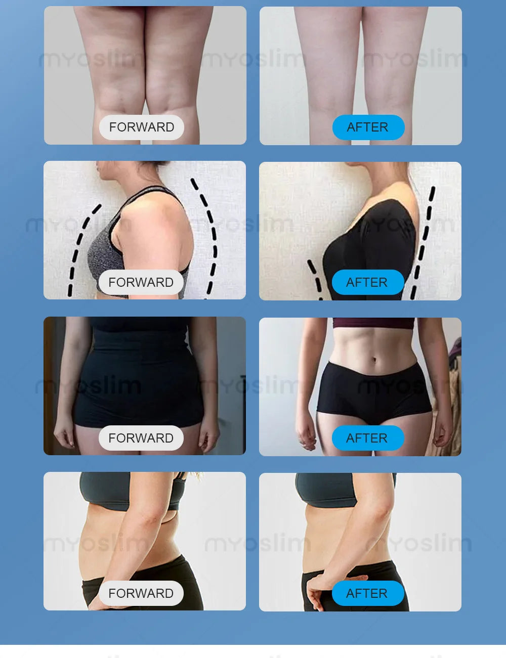 MYOSLIM 360 Degree Cooling Sculpting System For Body Slimming And Fat Freezing