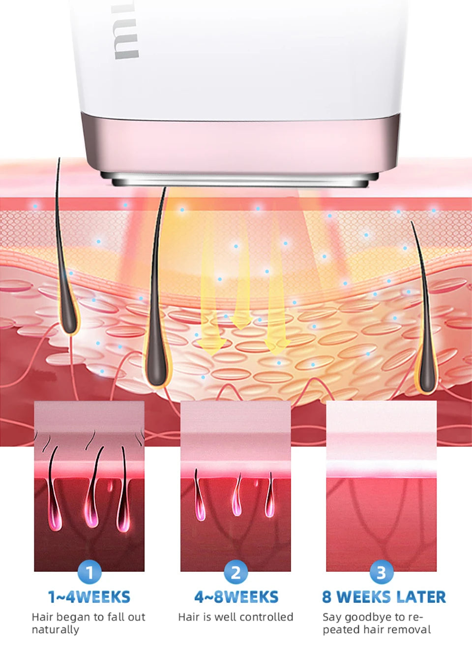 MLAY T4 IPL Laser Hair Removal Epilator For Home Use