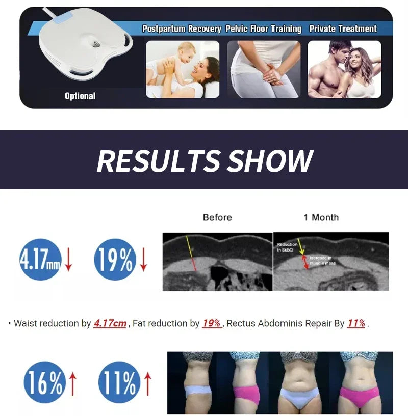 Myoslim RF High Intensity Electromagnetic Body Sculpting Machine