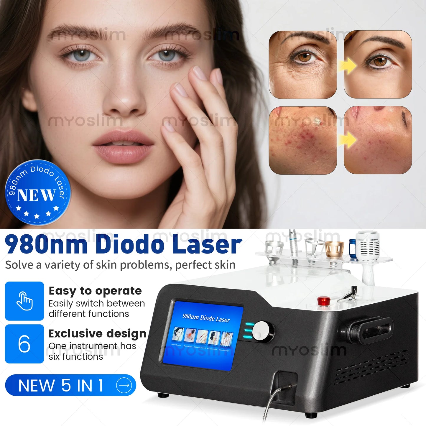 5 In 1 980nm Diode Laser Vascular Removal Nail Fungus