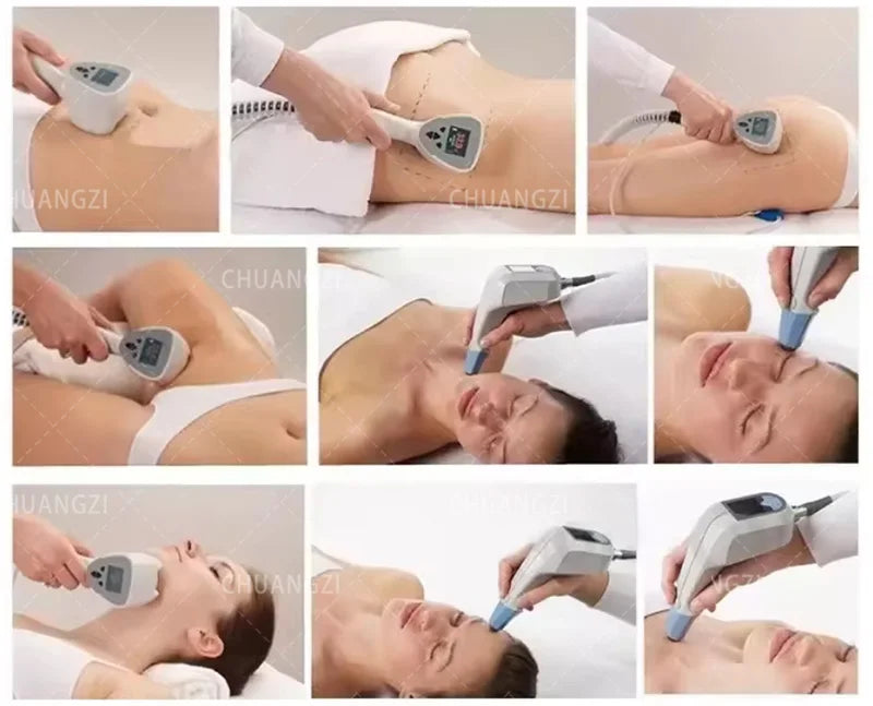 Professional Ultra 360 RF Body Slimming Machine For Home Use