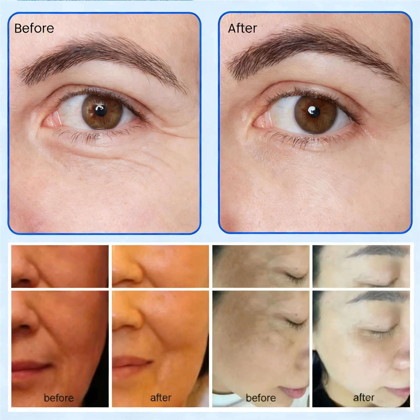 MYOSLIM 8 In 1 Plasma Beauty Machine With Cold Warm Ozone Microdermabrasion